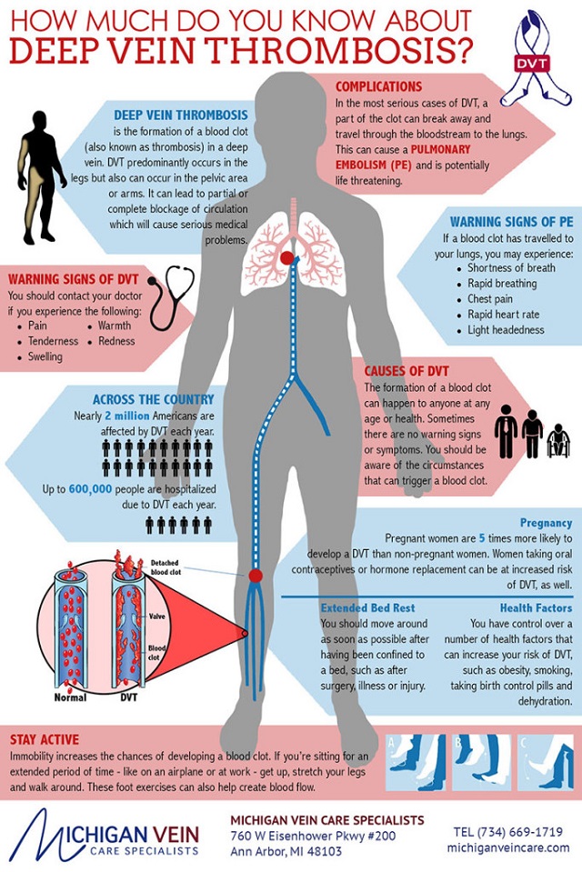 10 Signs And Symptoms Of Blood Clot In Leg