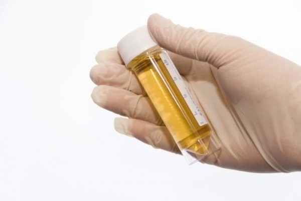 Blood Clots In Urine 10 Facts To Learn Today