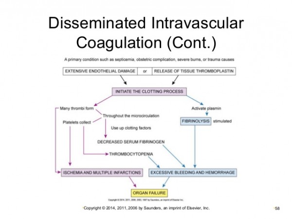 Disseminated Intravascular Coagulation Calgaryguide