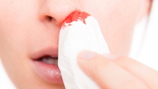 10 Causes Of Nose Bleeds Home Remedies