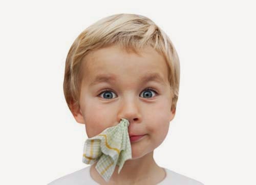 10 Ways To Stop Nose Bleed 